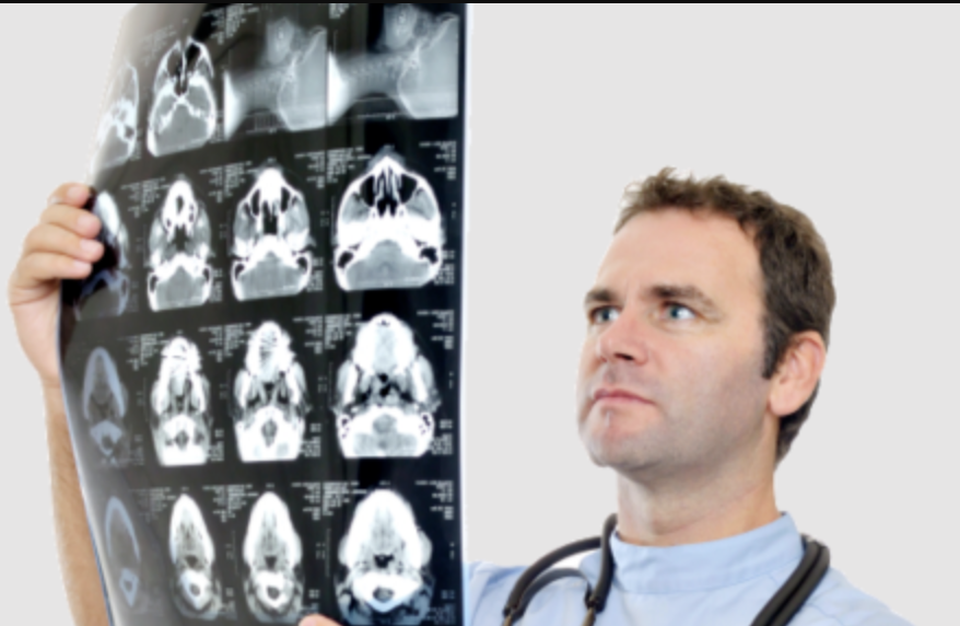 Imaging Cervices MRI, CT, X-ray for No Fault Patients