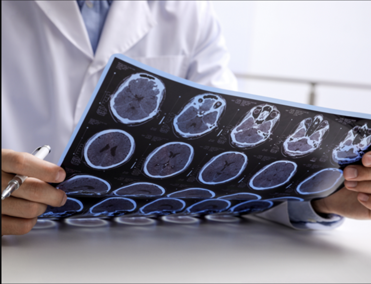 Brain MRI Brain MRI