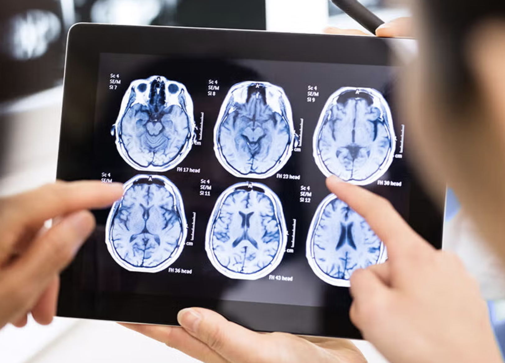 Brain MRI Brain MRI