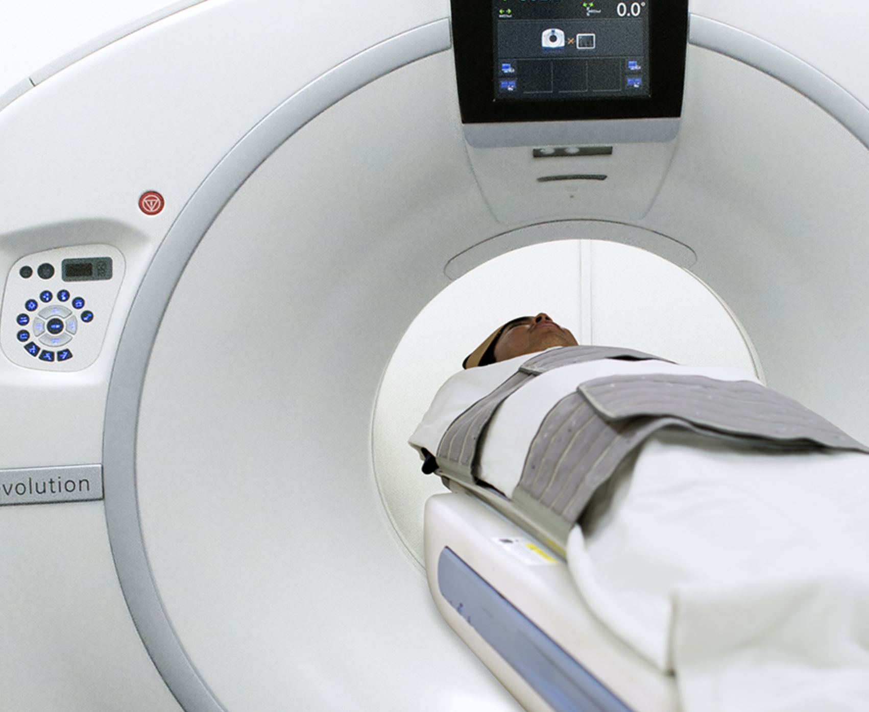 CT Lung Cancer Screening CT Lung