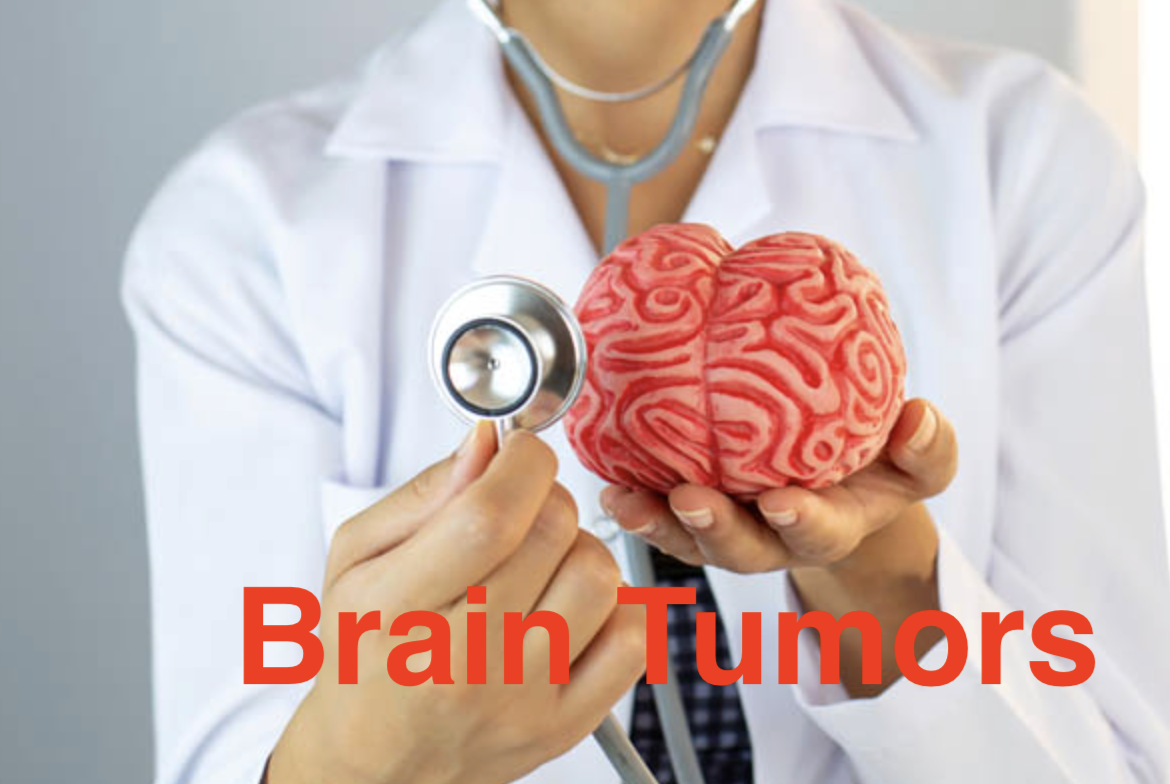 Not Every Headache Is a Brain Tumor — But Knowing Matters. Visit 14 Street Medical Arts Headaches? Let’s Find the Real Cause — Advanced Brain Imaging at 14 Street Medical Arts