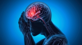 Neurologist evaluating a patient with migraine headaches at 14 Street Medical Arts in New York City