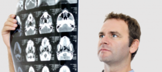 MRI, CT, X-ray for No Fault Patients
