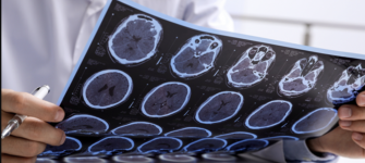 Brain MRI