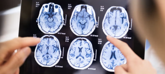 Brain MRI