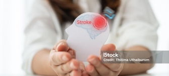 Neurologist explaining stroke warning signs and headache evaluation with Brain MRI and carotid ultrasound at 14 Street Medical Arts
